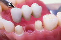 Cosmetic Dentistry – White Plains Family Dental