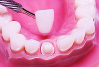 Cosmetic Dentistry – White Plains Family Dental