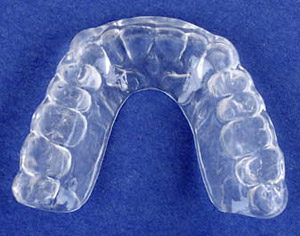 Teeth Wear & Grinding – White Plains Family Dental